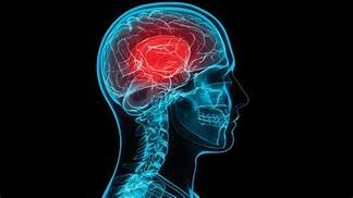 moustarah brain injury lawyers