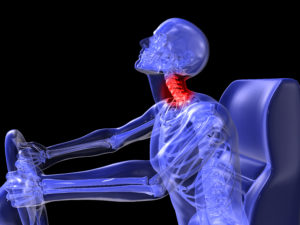 WHIPLASH: IS IT REALLY JUST A MINOR INJURY?