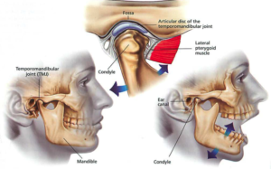 WHY DOES MY JAW HURT AFTER A CAR ACCIDENT?